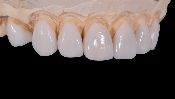dental-2036945__340 dental-2036945__340